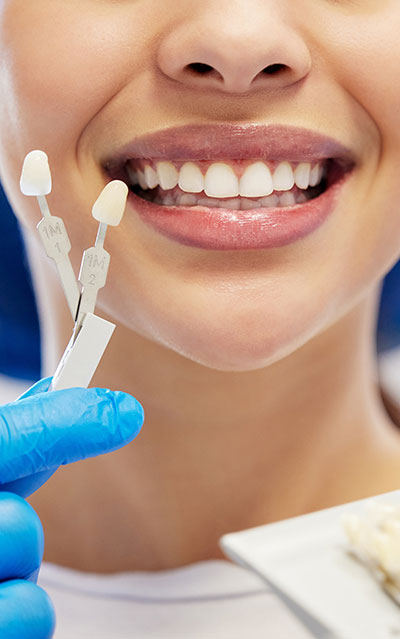woman veneers